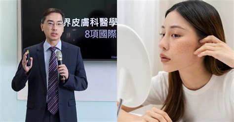 為什麼臉上會長斑|皮膚科醫師林政賢談斑點、美白、淡斑保養的6重點